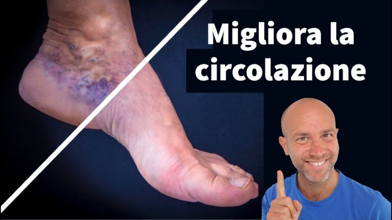 Gambe Nere negli Anziani: Cause e Rimedi